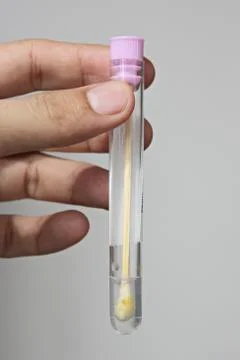 Stool test with samples inside. Stock Photos