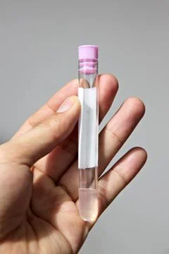 Stool test tubes in hand. Stock Photos