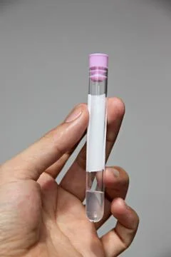 Stool test tubes in hand. Stock Photos