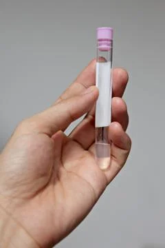 Stool test tubes in hand. Stock Photos