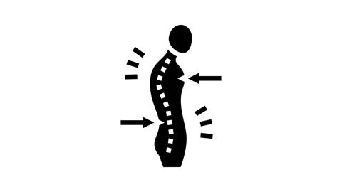 Stooped posture osteoporosis symptom glyph icon animation Video stock 326150941