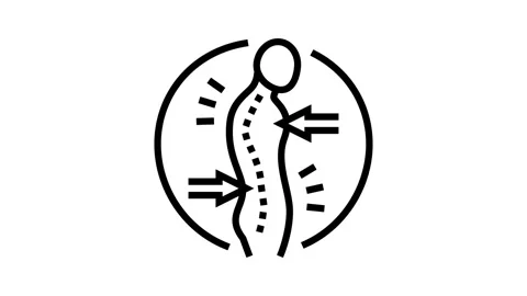 Stooped posture osteoporosis symptom line icon animation Video stock 326130424