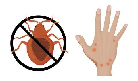 Stop bed bugs and skin rash caused by parasite bites Stock Illustration