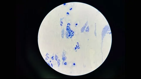 Stop motion Acid fast bacilli Negative. Stock Footage 229996498