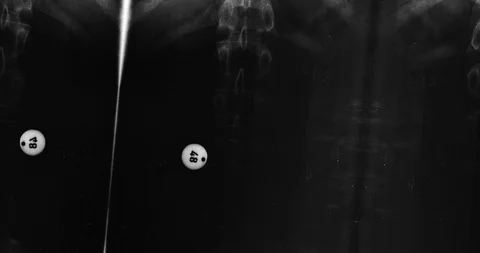 Stop motion animated X-ray texture background or luma matte Stock Footage 100975917