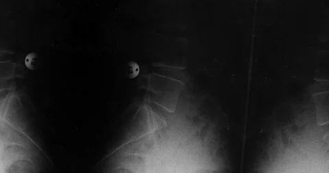 Stop motion animated X-ray texture background or luma matte Stock Footage 100976172