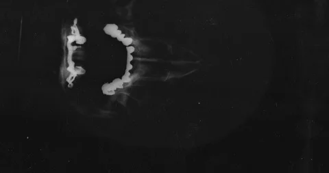 Stop motion animated X-ray texture background or luma matte Stock Footage 100976859