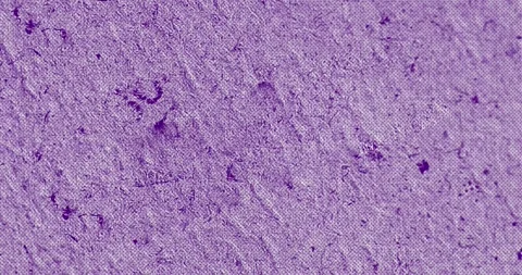 Stop motion animation of grungy and noisy uneben textured surface 스톡 동영상 252528664