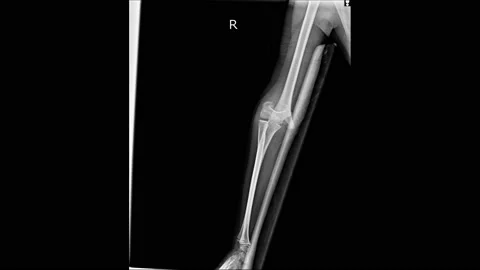 Stop motion of body parts ct or x-ray scan collection. Human hands, wrist, leg,  Stock Footage 158902012