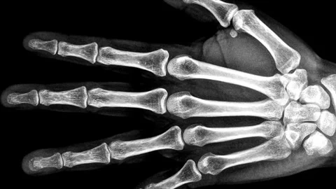 Stop motion loop of human body parts ct or x-ray scan. Horror collection. H.. Stock Footage 288031267