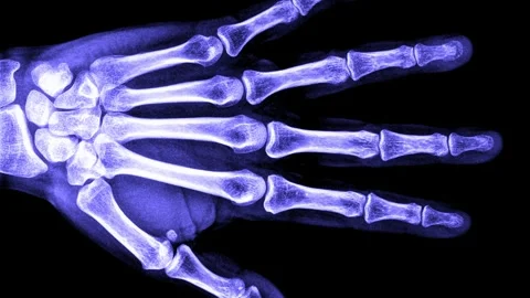 Stop motion loop of human body parts ct or x-ray scan. Horror collection. H.. Stock Footage 288032288