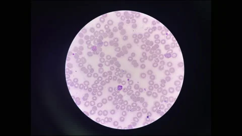 Stop motion malaria blood parasite. Stock Footage