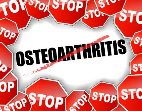 Stop osteoarthritis Stock Illustration