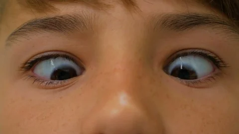 Strabismus at the boy Stock Footage 83635502