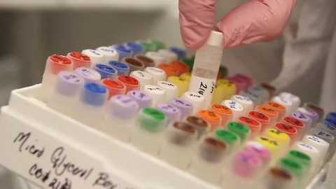 Strains of bacteria in vials Stock Footage 86822093