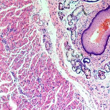 Stratified squamous epithelium Stock Photos