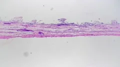 Epithelium cells of cavitas oris of huma Stock Video Pond5