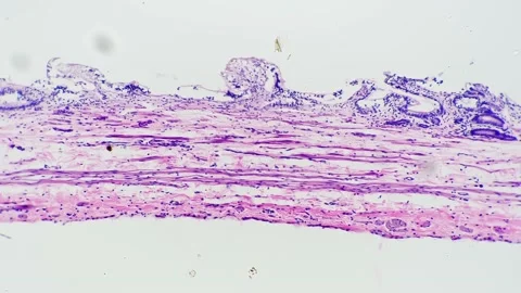 Stratified squamous epithelium in section magnified under microscope 100x Stock Footage 225538559