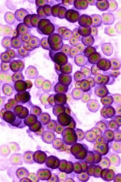  Streptococcus pyogenes Streptococci (Streptococcus pyogenes). Image made ... Stock Photos