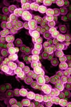  Streptococcus pyogenes Streptococci (Streptococcus pyogenes). Image made ... Stock Photos