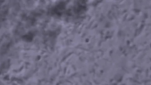 Streptococcus Staphylococcus, E. coli in human feces under a microscope. The max Stock-Footage 156523026