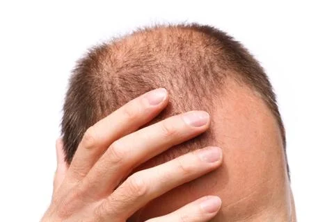 Stressed man Stock Photos