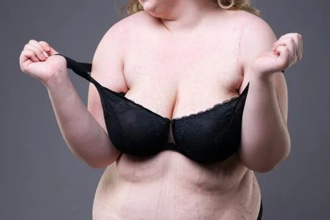 Stretch marks on a large natural breasts, obese woman with fat abdom Stock Photos