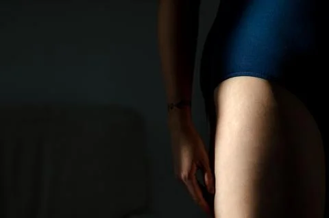 Stretch marks on legs after weight loss close up. Skin care. Stock Photos