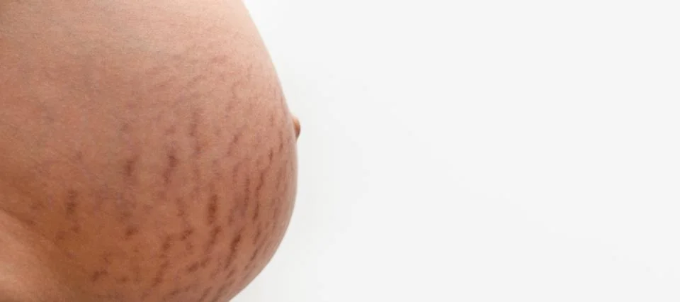 Stretch marks panoramic Stock Photos