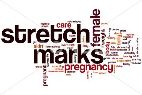 Stretch marks word cloud Stock Illustration