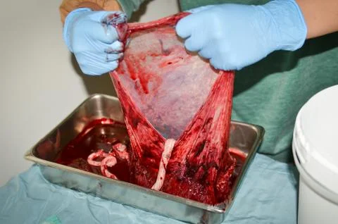Stretched Open Human Placenta View Stock Photos