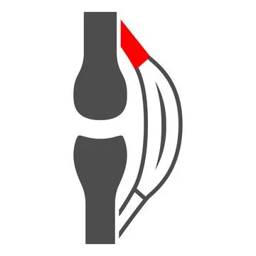 Stretched tendon solid icon, body pain concept, strain vector sign on white イラスト素材