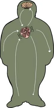 Stroke diagram Stock Illustration