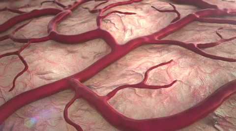 Stroke, insult, brain Stock Footage 57823684