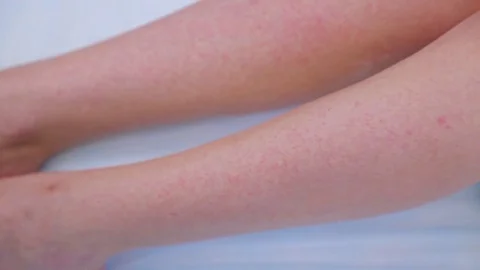 Stroking the women's legs after the procedure shugaring Stock Footage