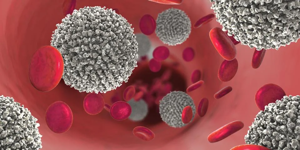Strong increase of non-functional white blood cells called leukemia Stock Illustration