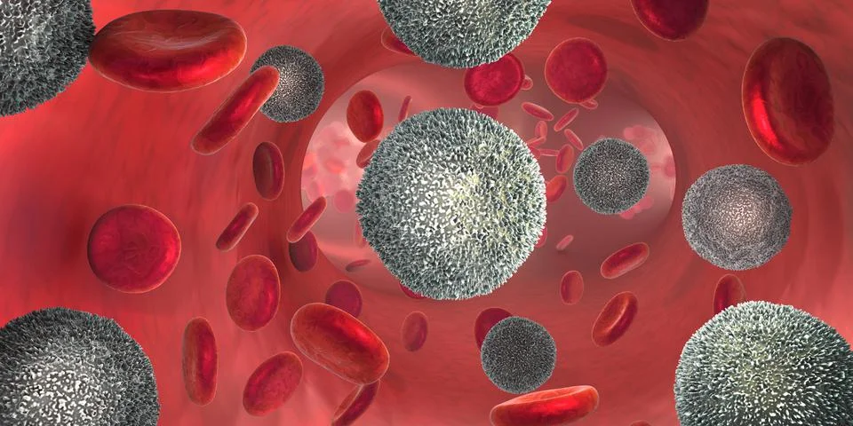Strong increase of non-functional white blood cells called leukemia Stock Illustration