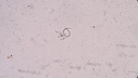 Strongloides stercoralis 스톡 동영상 75697406