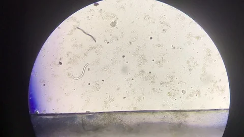 Strongyloides moving in stool eaxam. Stock Footage 126459828