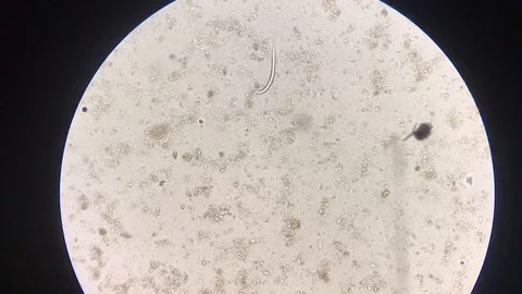 Strongyloides moving in stool exam. Stock Footage 126459849