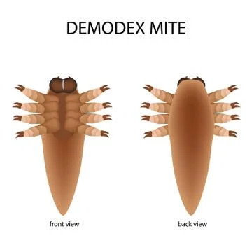 The structure of the demodex mite. Front view and rear view. Demodecosis Stock Illustration