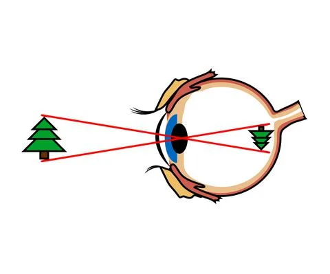 The structure of the human eye. Cartoon. Stock Illustration