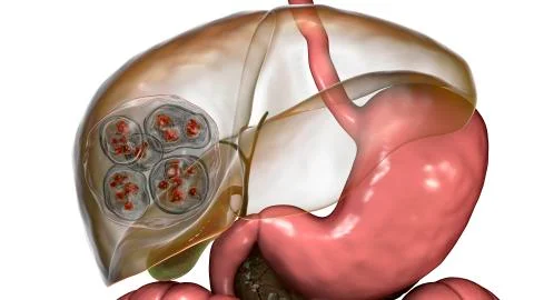 Structure of hydatid cyst of Echinococcus multilocularis, 3D illustration. E. Stock Illustration