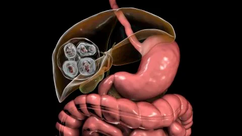 Structure of hydatid cyst of Echinococcus multilocularis, 3D illustration. E. Stock Illustration
