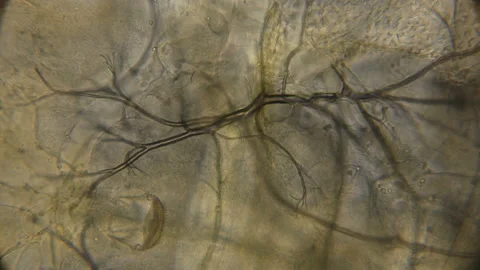 Structure of internal organs of the larva Lesser water boatman under a Stock Footage 90236467