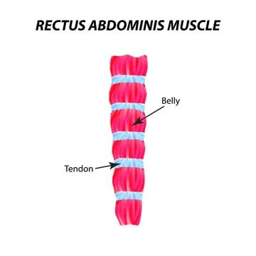 The structure of skeletal muscle. rectus abdominis muscle. Tendon. Infographics Stock Illustration