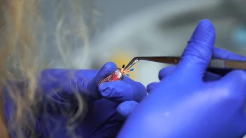 Students of dentists learn to fill the root canals of artificial teeth. Stmatlog Stock Footage 124324532
