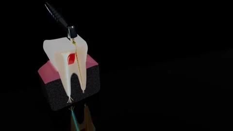 Studio view of molar cross section during root canal procedure, 4K Stock Footage 346121169