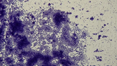 Study of bacteria under a microscope. Stock Footage 88200694