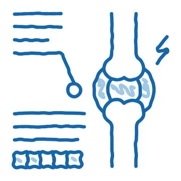 Study of bone arthritis doodle icon hand drawn illustration Illustrazione stock